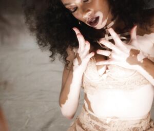 Sexy Love Advent 2017 - Day 15 - Winnie Harlow by Phil Poynter