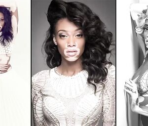 Winnie Harlow not Nude Model (2018)